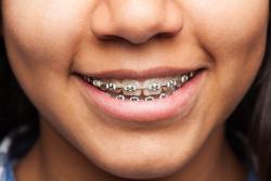 orthodontie guyancourt